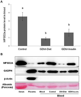 Child Head Circumference and Placental MFSD2a Expression Are Associated to the Level of MFSD2a in Maternal Blood During Pregnancy